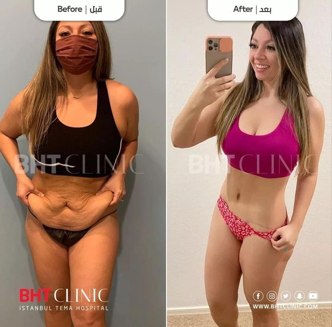 Full-length view — before and after, photo 1